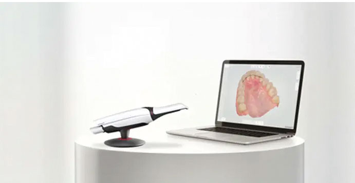 Scanner intraorale digitale