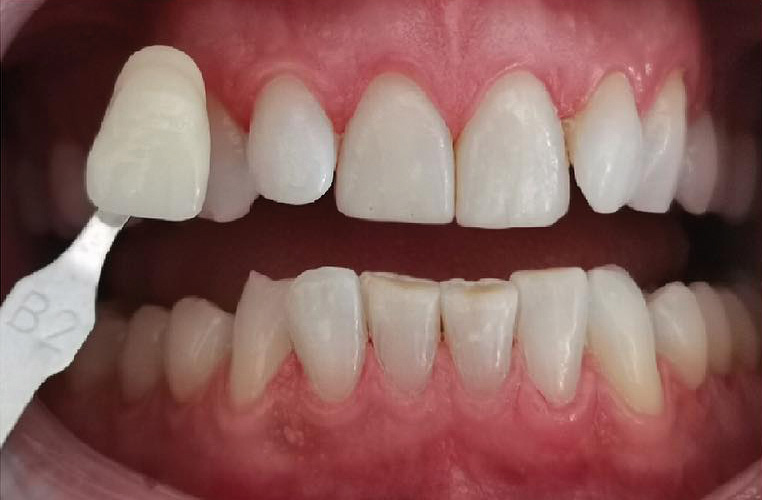 igiene dentale varese